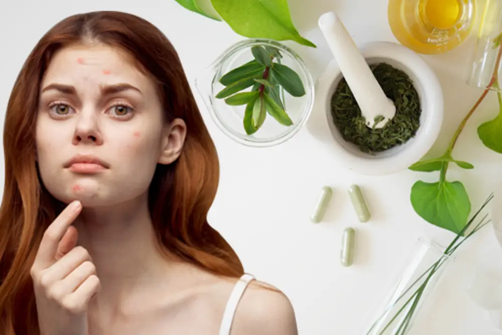 ayurvedic-pimples-treatment-in-pune-skinhairayurved