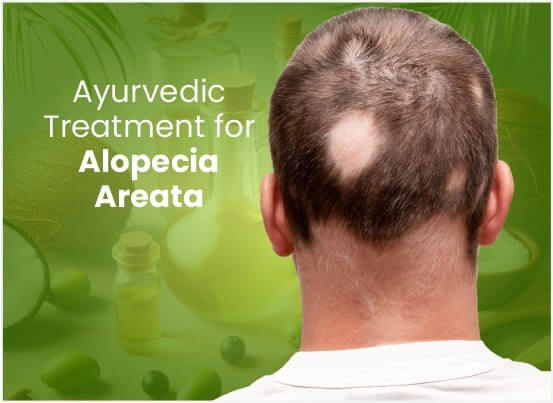 Ayurvedic Alopecia Areata Treatment in Pune