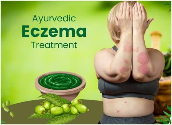 Ayurvedic Eczema Treatment in Pune