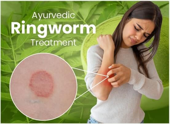 Ayurvedic Ringworm Treatment