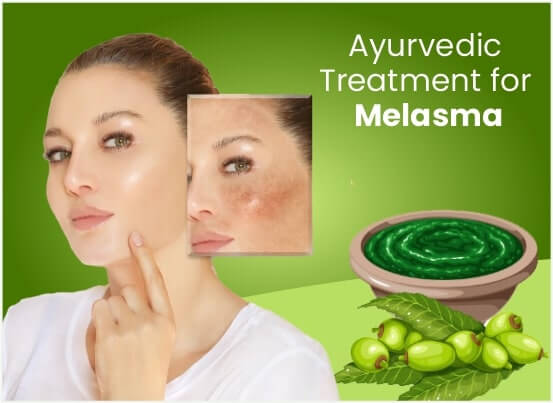 Ayurvedic Treatment for Melasma in Pune