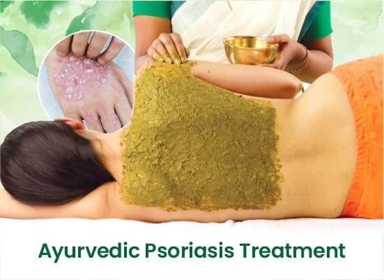 Ayurvedic psoriasis Treatment