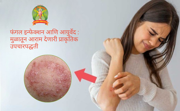 फंगल इन्फेक्शन आणि आयुर्वेद : मुळातून आराम देणारी प्राकृतिक उपचारपद्धती :-